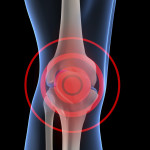 Knee-pain 2